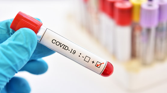Vial de prueba COVID-19 marcado como positivo
